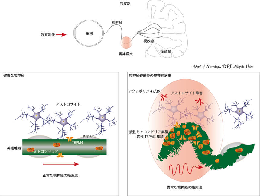 視神経脊髄炎の視機能障害の臨床免疫病理学的解析