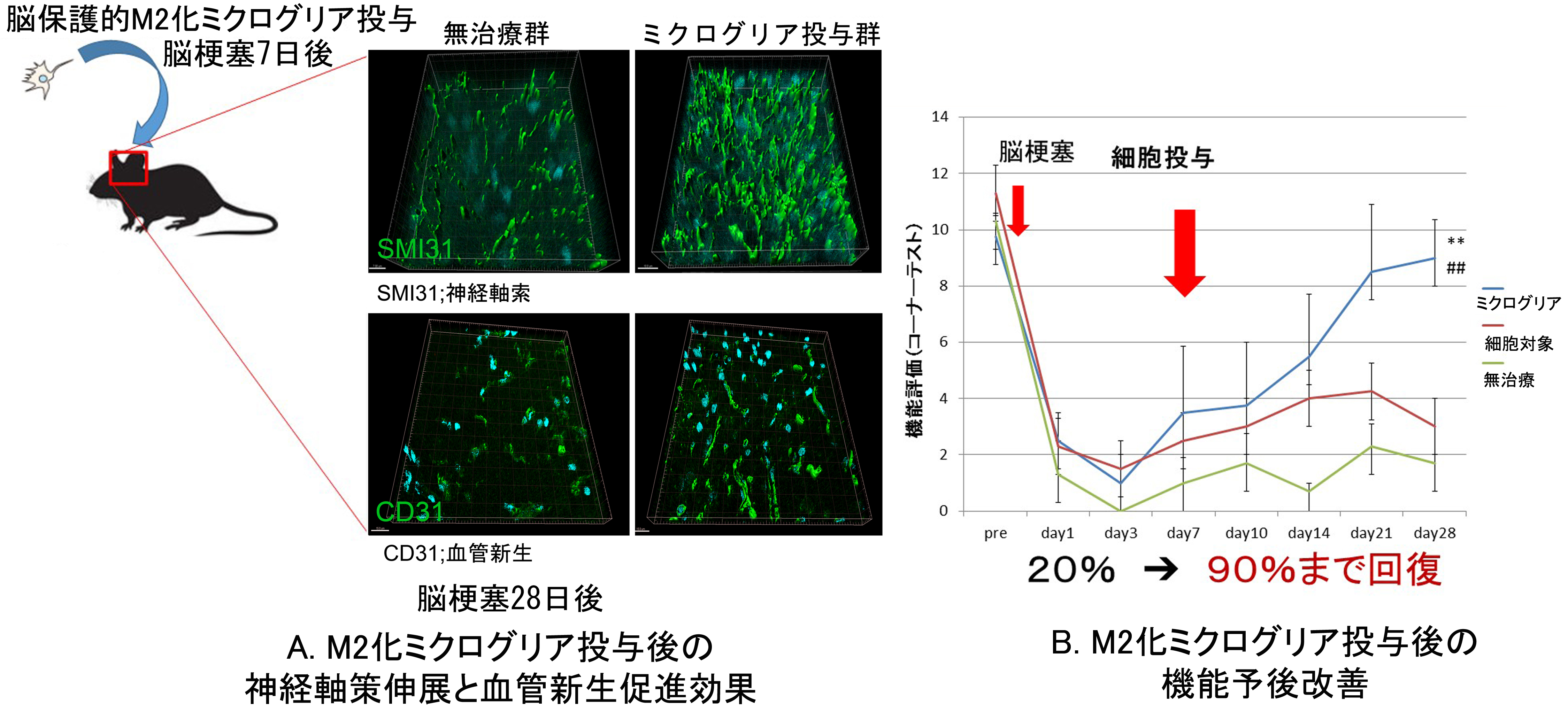 肝臓外科代謝免疫研究 | 研究紹介 | 京都大学附属病院肝胆膵