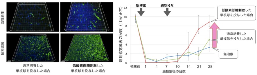 OGD刺激保護的PBMC投与による脳梗塞機能回復療法
