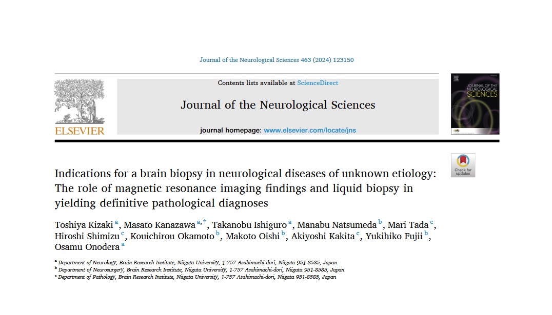 木崎利哉 先生の論文がJournal of the Neurological Sciences誌に掲載